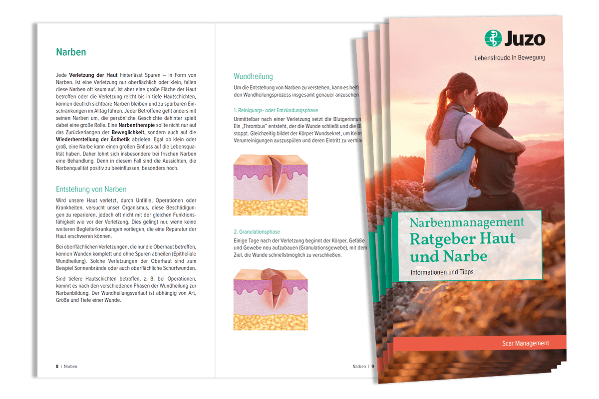Narbenmanagement: Ratgeber Haut und Narbe Juzo