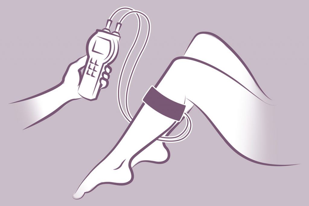 LRR Messgerät für Kompressionstherapie Phlebologie Grafisch dargestellt