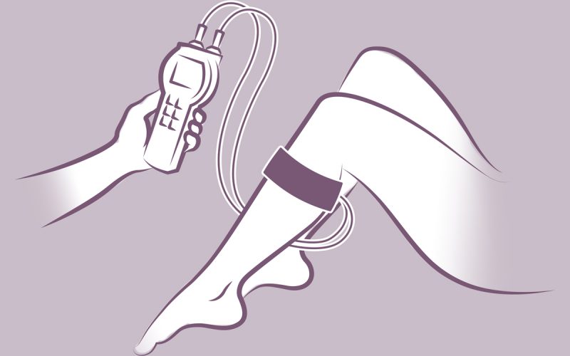 LRR Messgerät für Kompressionstherapie Phlebologie Grafisch dargestellt